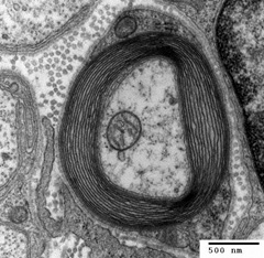 easybiologyclass, electron micrograph of myelin sheath around nerve axon