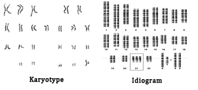 What is Karyotype?