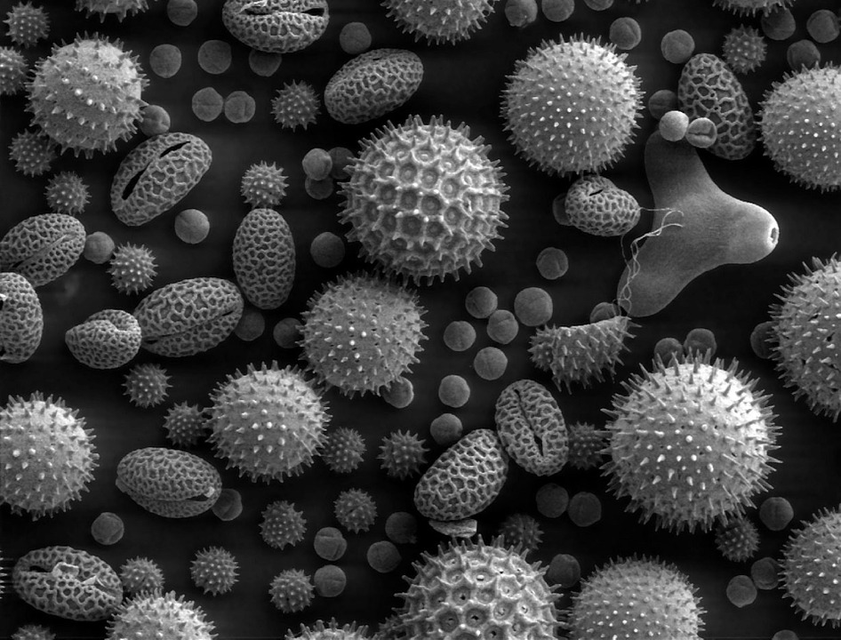 Pollen grains under Electron Microscope