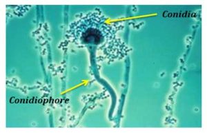 aspergillus-conidia-with-conidiophore | EasyBiologyClass