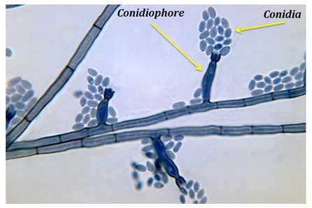 conidiophore and conidiospores