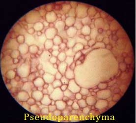 what is pseudo parenchyma