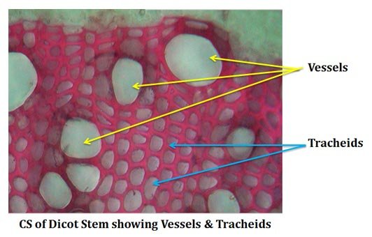 what is tracheid