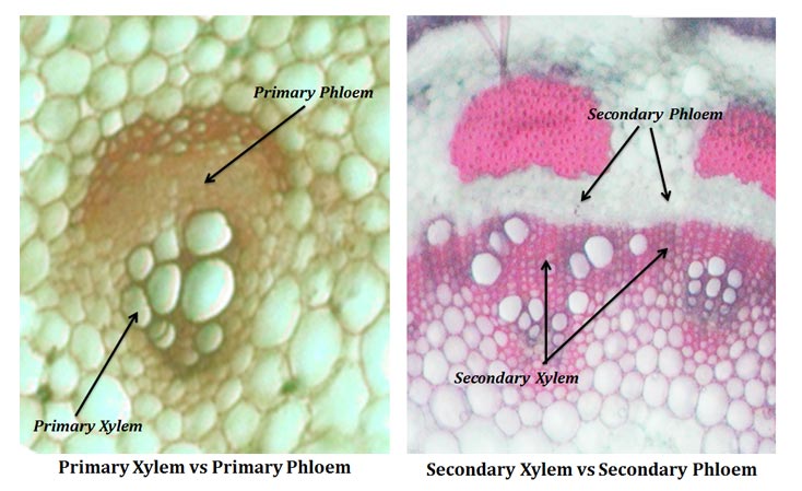 secondary xylem and primary xylem