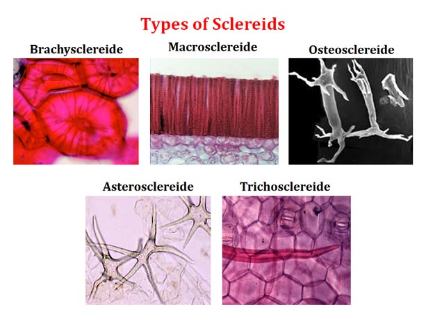 osteosclereids macrosclereids