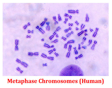 metaphase chromosome of human