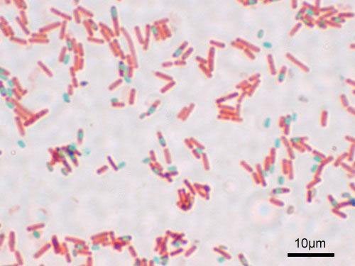 Endospore vs Vegetative Cell