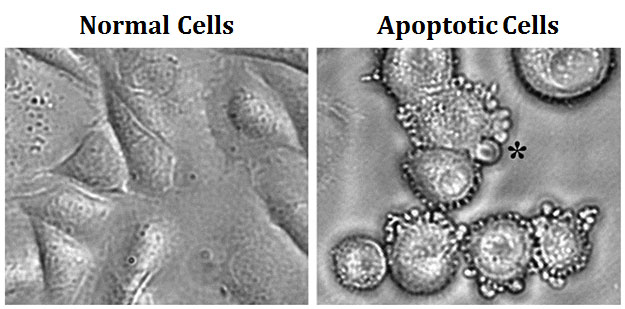 Features of Apoptosis