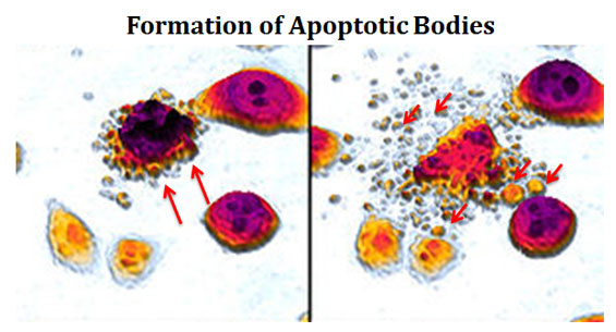 define apoptotic bodies