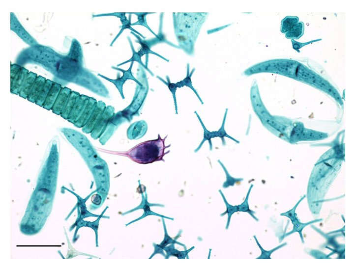 Hydrosere Definition and Seral Stages (PPT) EasyBiologyClass