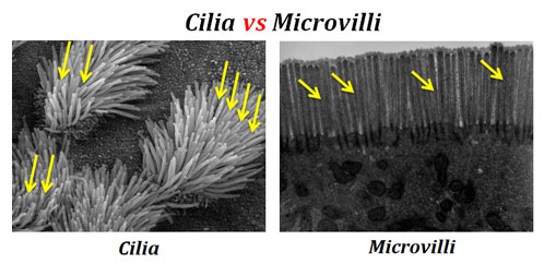 Difference between Cilia and Microvilli