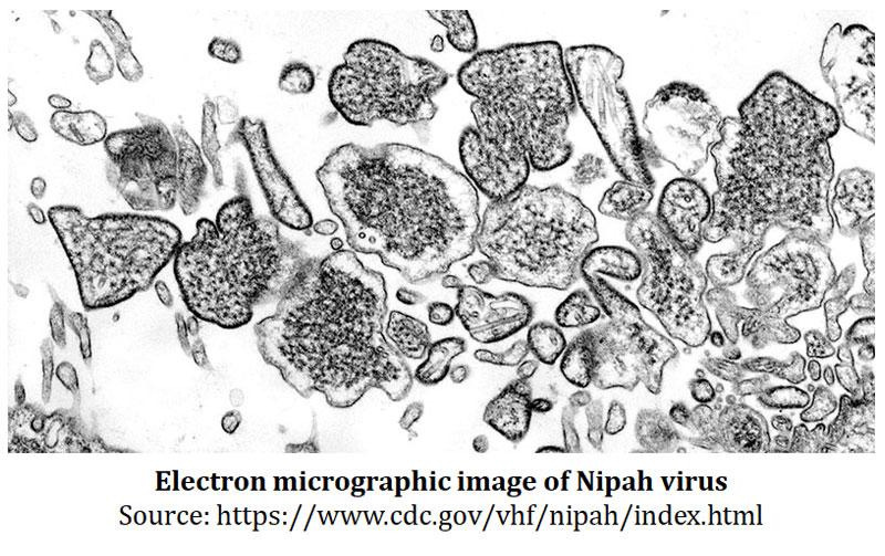 nipah infection